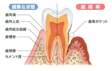 歯の構造を説明｜香川県高松市の吉本歯科医院